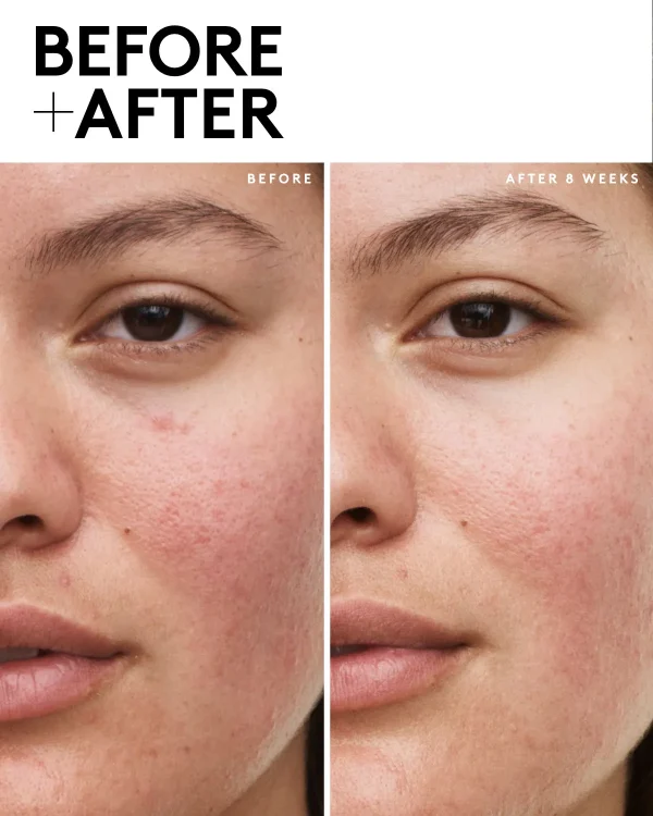 Fenty Skin Vault 5-Piece AM + PM Skincare Essentials - Image 4
