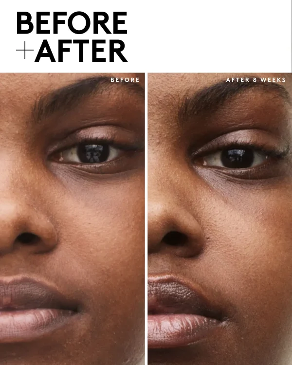 Fenty Skin Travel-Size Start’r Set with Mineral SPF: Dry Skin Edition - Image 4