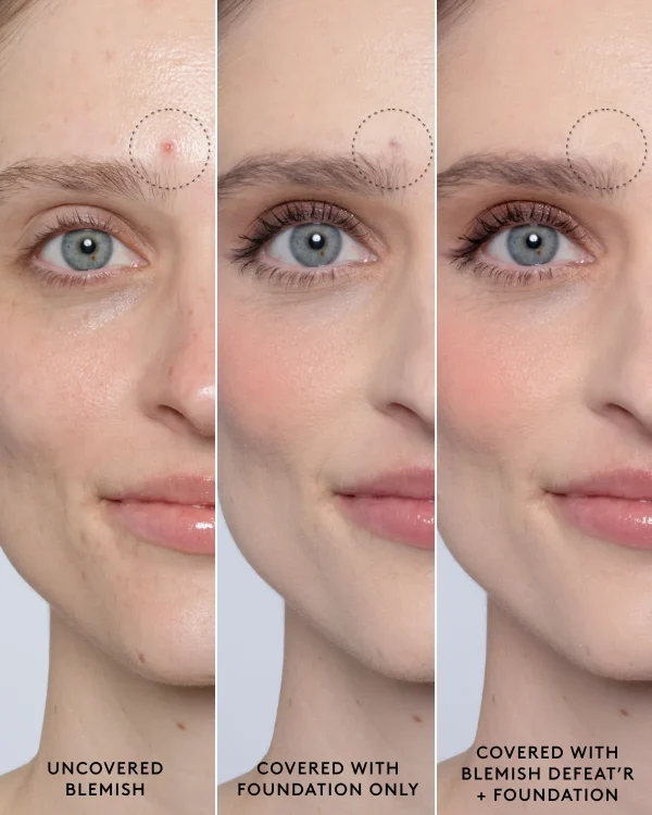 Blemish Defeat’r BHA Spot-Targeting Gel - Image 8