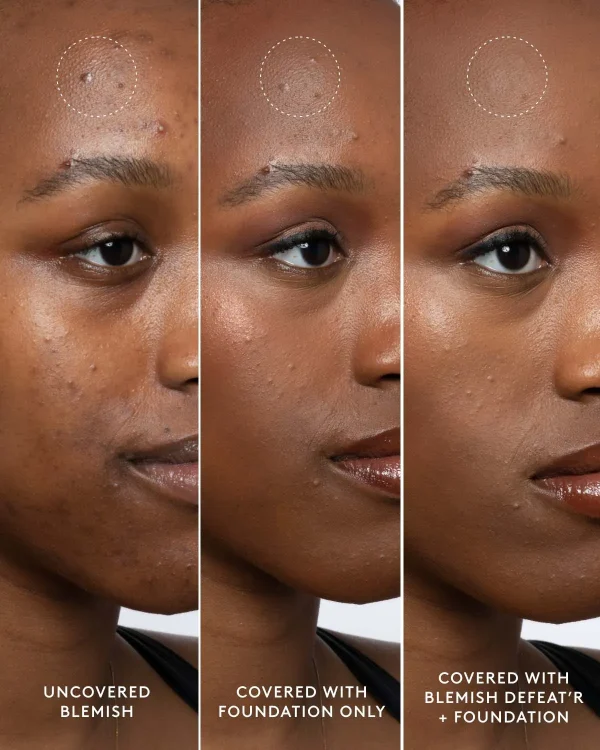 Blemish Defeat’r BHA Spot-Targeting Gel - Image 9