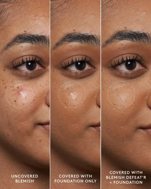 Blemish Defeat’r BHA Spot-Targeting Gel - Image 2