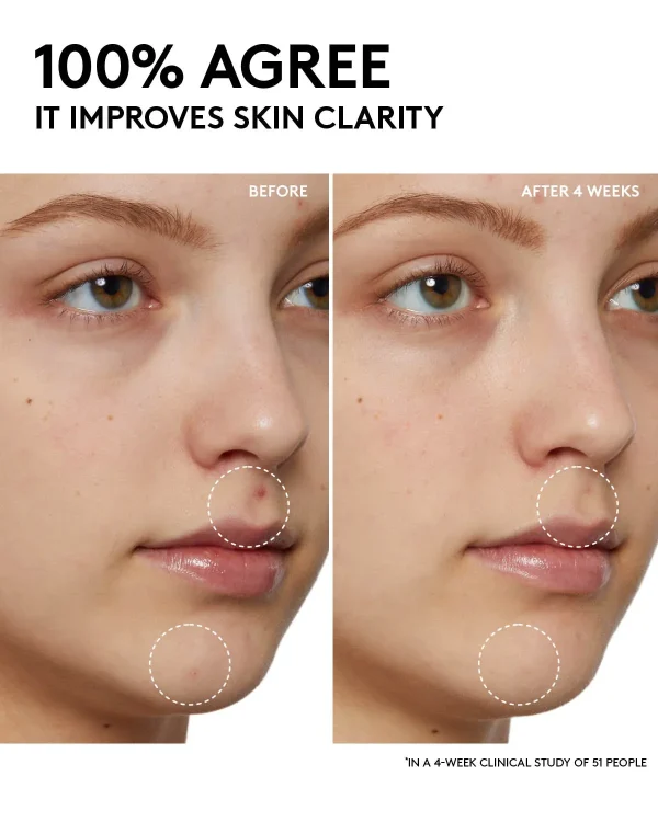 Cherry Dub Pore Purify’r Gel Cleanser with Niacinamide + Aloe Juice - Image 5