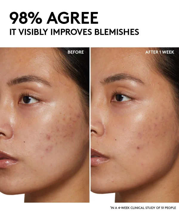 Cherry Dub Pore Purify’r Gel Cleanser with Niacinamide + Aloe Juice - Image 6