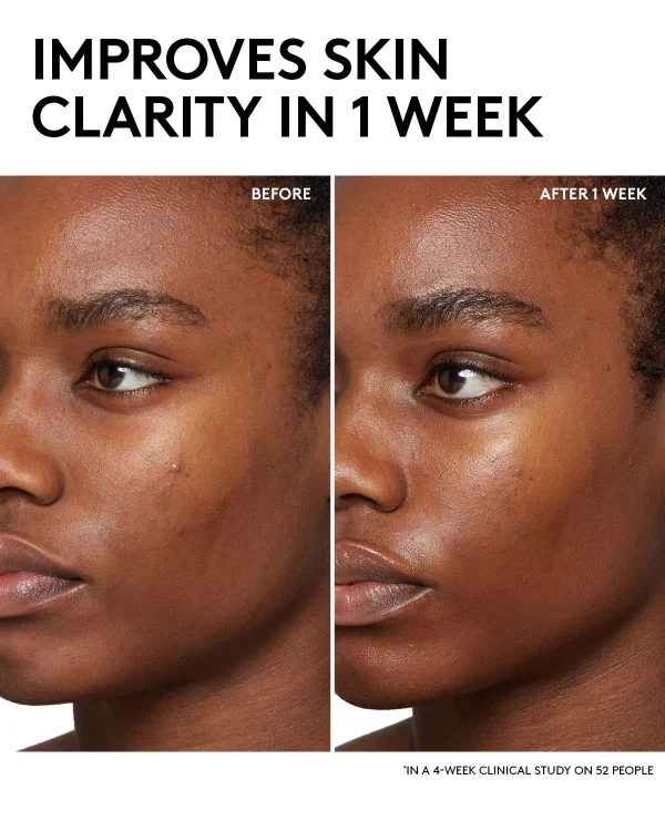 Fenty Skin Start’rs Full-Size Bundle with Mineral SPF: Oily Skin Edition - Image 3