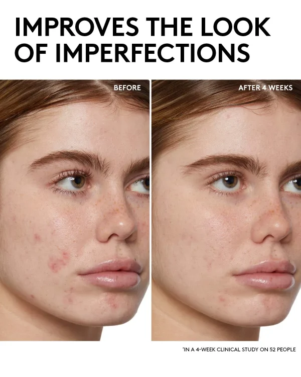 Fenty Skin Start’rs Full-Size Bundle with Mineral SPF: Oily Skin Edition - Image 4
